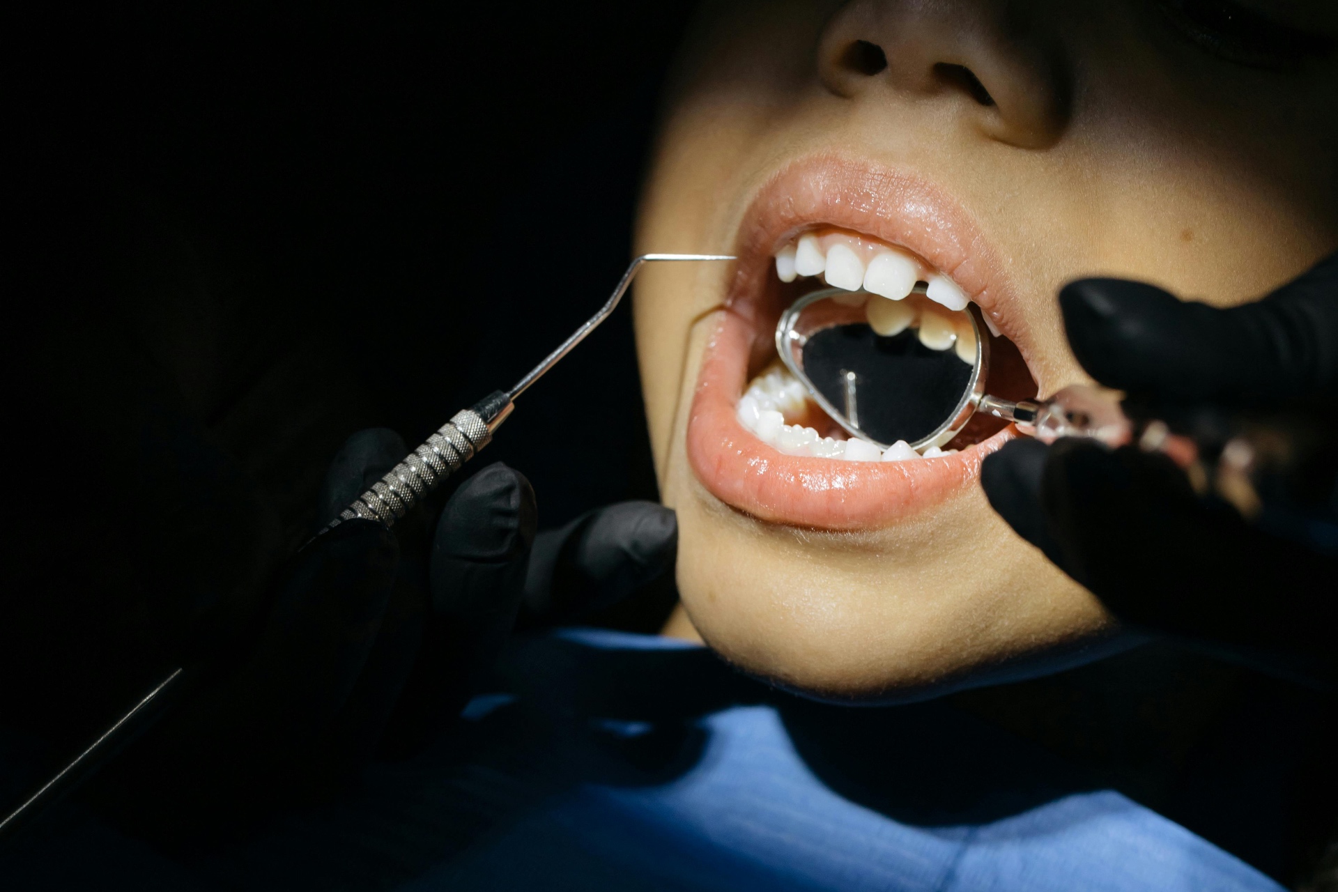 Close-up of a child's healthy teeth being examined with a dental mirror and probe