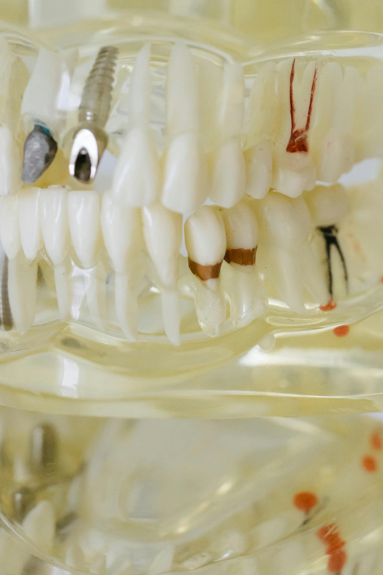 Anatomical model showing the internal root structure of a tooth
