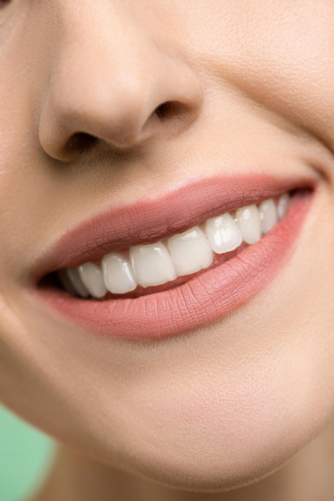 Teeth Whitening